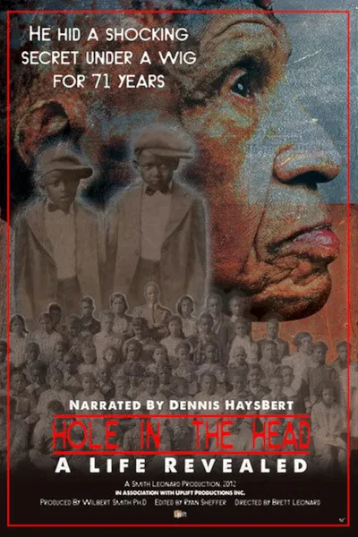 Hole in the Head: A Life Revealed